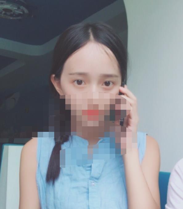 北京八大處趙延勇醫(yī)生做雙眼皮怎么樣？