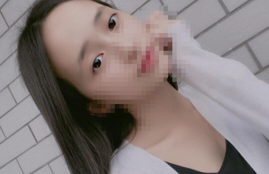 北京八大處趙延勇醫(yī)生做雙眼皮怎么樣？