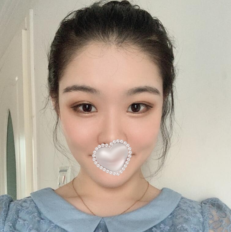 鄭州諾顏一生湯芳芳熱瑪吉案例