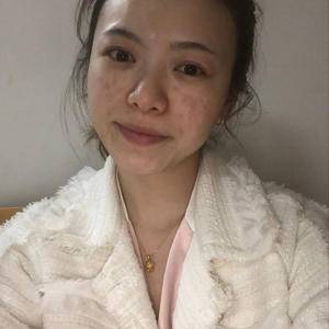 激光可以去除黃褐斑嗎