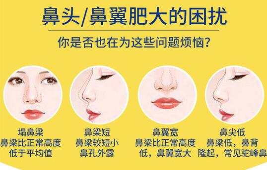 鼻翼肥大整形多少錢