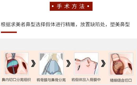 硅膠隆鼻的副作用