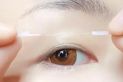 單眼皮如何變雙眼皮