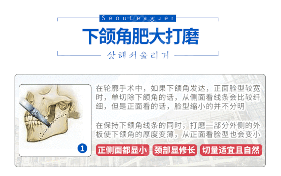 整瓜子臉手術(shù)方法