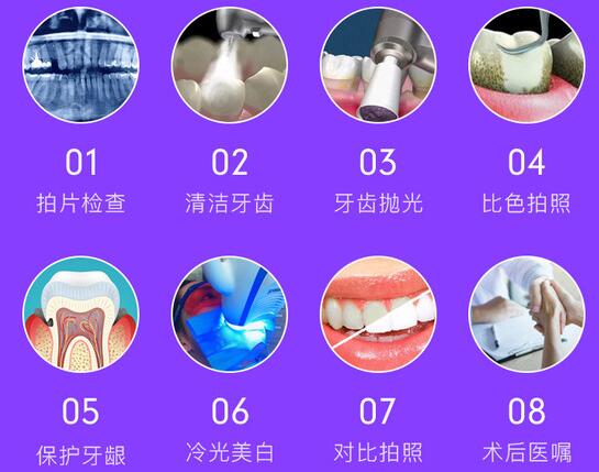 冷光美白牙齒的特點(diǎn)
