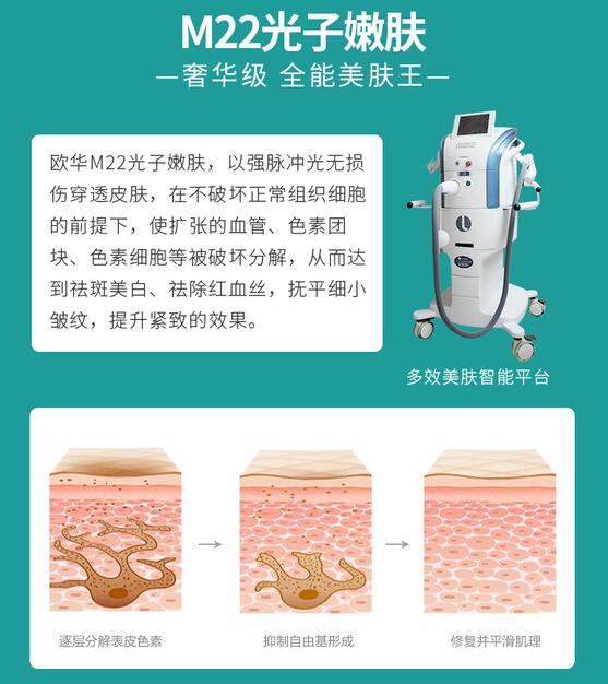 全身光子嫩膚多少錢