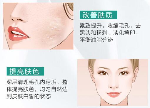 全身光子嫩膚的作用