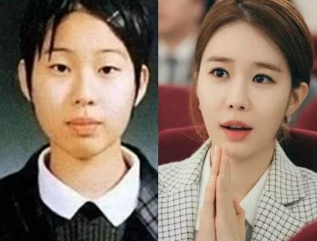 劉仁娜整容前對(duì)比