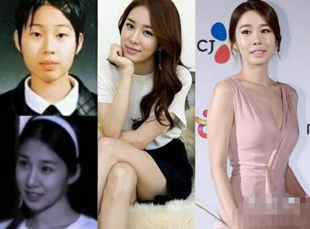 劉仁娜整容前對(duì)比